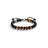 Tiger Eye
